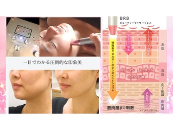 ビューティークリニーク アマーレ(Amare)の写真/あの頃に帰りたい・・・お顔・首・鎖骨・頭皮からアプローチ。結婚式直前SOSレスキュー☆