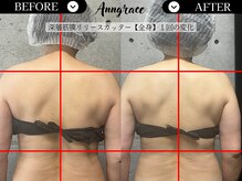 アングレイス(Anngrace)/