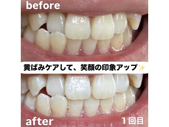 マミー(mammy)/黄ばみ・くすみをケア♪