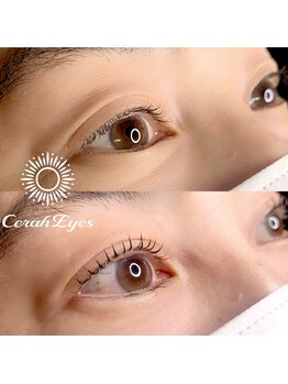 チュラアイズ(CerahEyes)/【お客様ビフォーアフター】