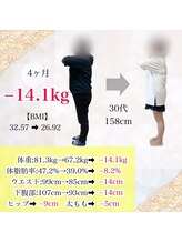 ヒデ整体院(Hide整体院)/4ヵ月で－14.1kg痩身＆骨盤矯正