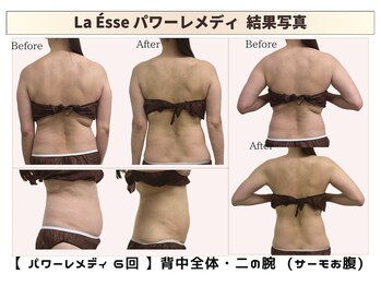 ラエッセ(La Esse)/背中とお腹同時に引き締め
