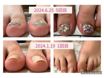 ブロックファイブハナ(Block 5 HANA)/