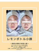 ソワナ(soina)/【神楽坂駅/フェイシャル/毛穴】