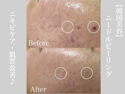 サロン ウルハ(Salon Uruha)の写真