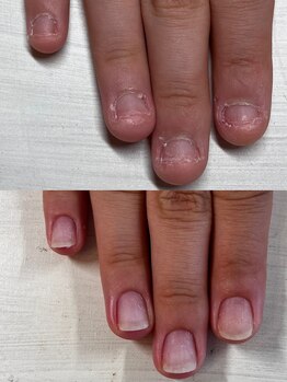 ヴェールリム(verl lim)/