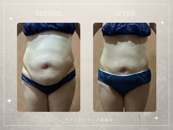 アバンダンティア 姫路店/