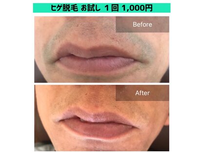 エヌプラス(N plus+)の写真