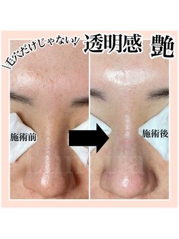 ルネッタ(Lunetta)/