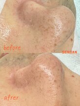 洗顔サロン 池袋(SENGAN)/メンズフェイシャルで清潔感UP