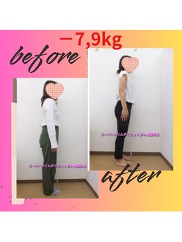 スーパースリムダイエット茅ヶ崎 茅ヶ崎整体院/3ヵ月－7,9ｋｇ減ダイエット♪