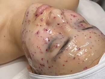 テン(10ten)の写真/【西宮北口/NEWOPEN】フェイシャルWAXで産毛や角栓もごっそり◆ぷるんと密着・ハイドロジェリーマスク
