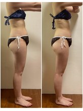 ニコワ(Nicowa)/Nicowaの痩身★BeforeAfter