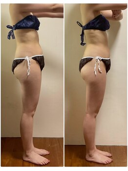 ニコワ(Nicowa)/Nicowaの痩身★BeforeAfter