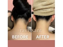 ラヴィソン(ravissant)