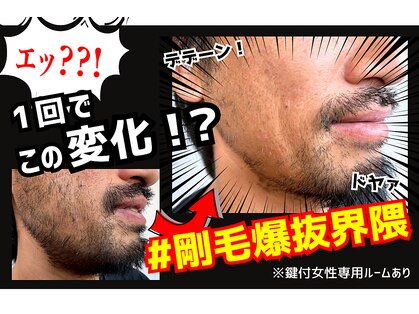 リトリル(LTLYL)の写真