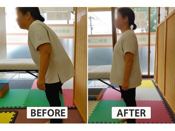 からだ回復センター 八幡西/激痛で曲がってる腰もスッキリ!