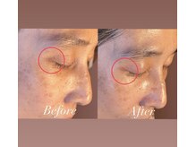 オーガニック100％フェイシャルケア