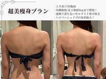 ラブミー 渋谷本店(LoveMe)/骨盤/ハイパーナイフEX/渋谷痩身