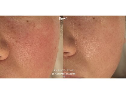 アールエーサロン 恵比寿 広尾(Ra salon)の写真