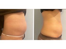 ルナグランデ(Luna grande.)/下っ腹も解消！