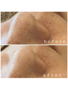 メナードフェイシャルサロン 岐阜茜部/エイジングケア/しわたるみケア