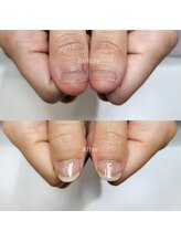 ミンスネイル(Mins Nail)/