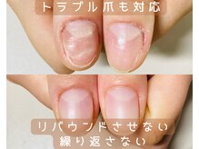 セルニの雰囲気(名古屋【深爪・かみ癖改善」爪トラブルも対応、縦長美爪に育成)