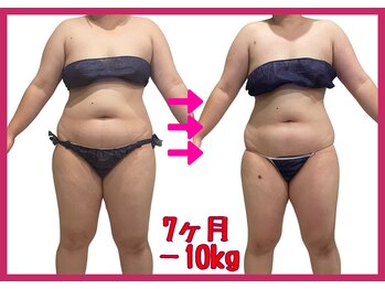 シュエットプラス(Chouette+)