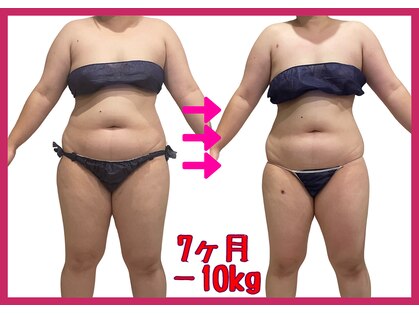 シュエットプラス(Chouette+)の写真