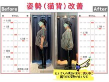 しのまる整体/猫背や全体的な傾きが改善!