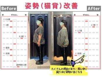 しのまる整体/猫背や全体的な傾きが改善!