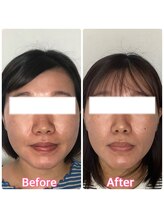 真心美/お顔の形って変わるんです