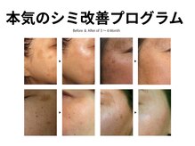 イーズサロン 美男美女 奈良三条店の雰囲気(心ほどける、上質な癒しの空間の中で本気のシミ改善プログラム)