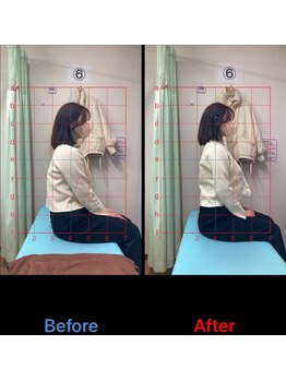 西葛西南口鍼灸整骨院/全身矯正＋鍼施術で姿勢改善！