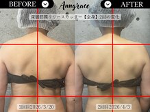 アングレイス(Anngrace)/