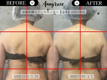 アングレイス(Anngrace)/