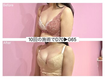 ククナ 新潟本店(KUKUNA)/*バストアップケア*