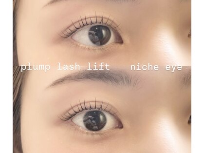 ニーチェ アイ(niche eye)の写真