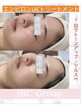 IBC 上大岡店/エンビロンフェイシャル
