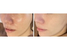 メアリーウィズ(Mary with)の雰囲気（【毛穴ざらつき　毛穴開き】お任せトリートメント）