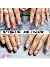 マミー(mammy)/ガタつきのあるお爪もお任せ！