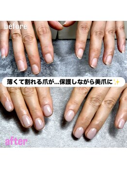 マミー(mammy)/ガタつきのあるお爪もお任せ！