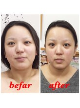 ブランソワン/たった1回の変化