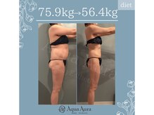 ボディエステティック アクアオーラ 高岡店/別人級の変化です★