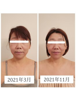 エクラ(eclat)/お客様の変化