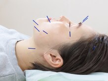 たかはし整骨院/