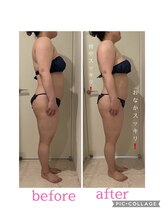 モイス(moisu)/80分でサイズダウンが叶う