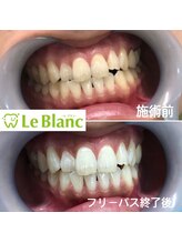 ルブラン 奈良店(Le Blanc)/周りと差をつけましょう！