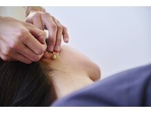 クボ鍼灸院の雰囲気（耳のお灸）